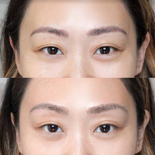 Microblading & Permanent Makeup Laser Removal | Eye Design Studio