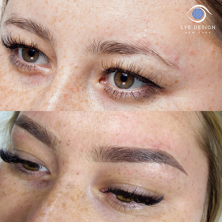 Eyebrow Microblading tattoo removal and correction repair Page 3 - Eye Art  Studio